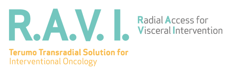 featured_radial_tri30th_product_ravi_980x320