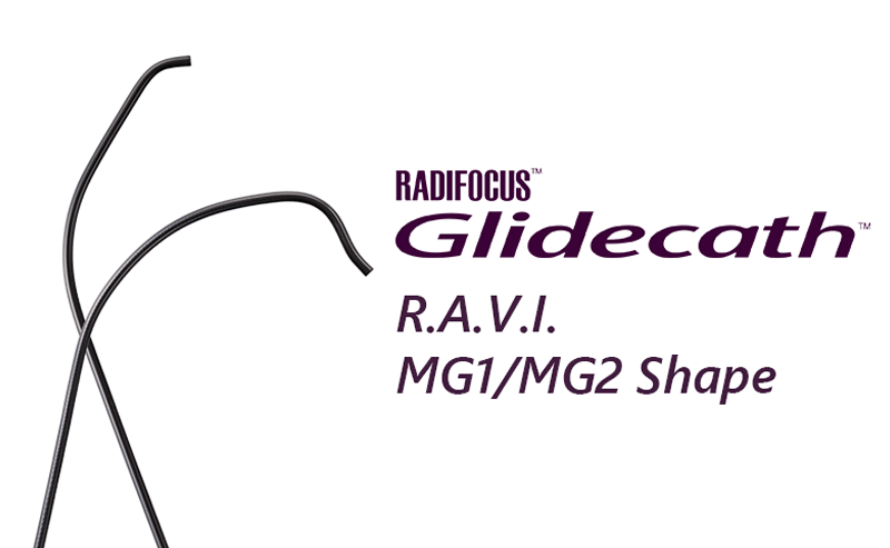 RADIFOCUS Glidecath R.A.V.I. MG1/MG2 shape (image)