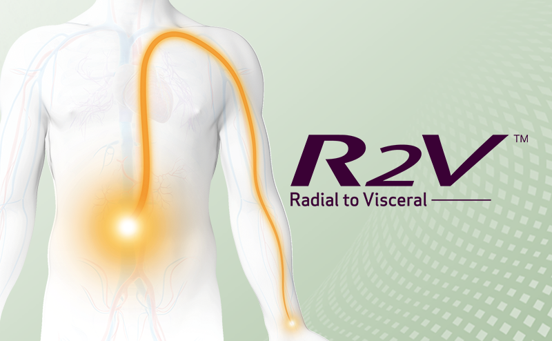 radial to visceral (image)
