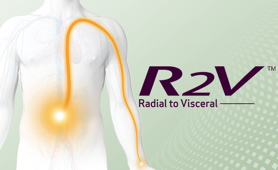 R2V - Radial to Visceral (image)