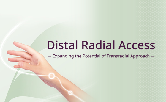 Distal Radial Access (image)