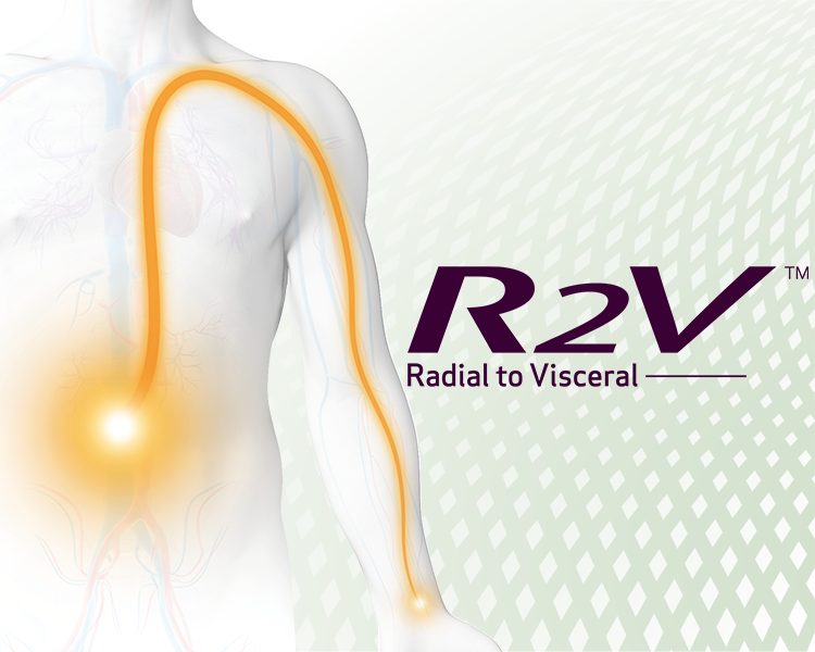 R2V™ - Radial to Visceral (image)