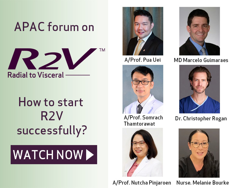 APAC Forum on R2V - How to start R2V successfully? (image)