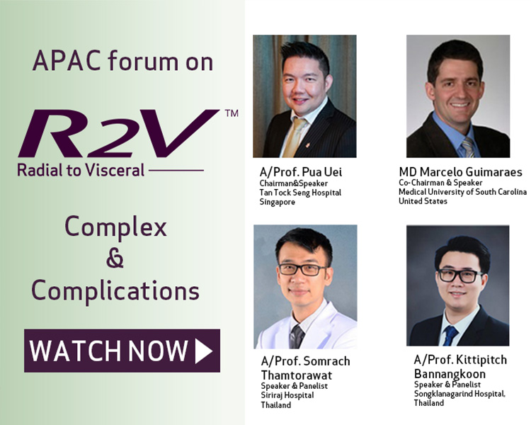 featured_radial_to_visceral_carousel_apac2023_webinar_sp_750x600.png