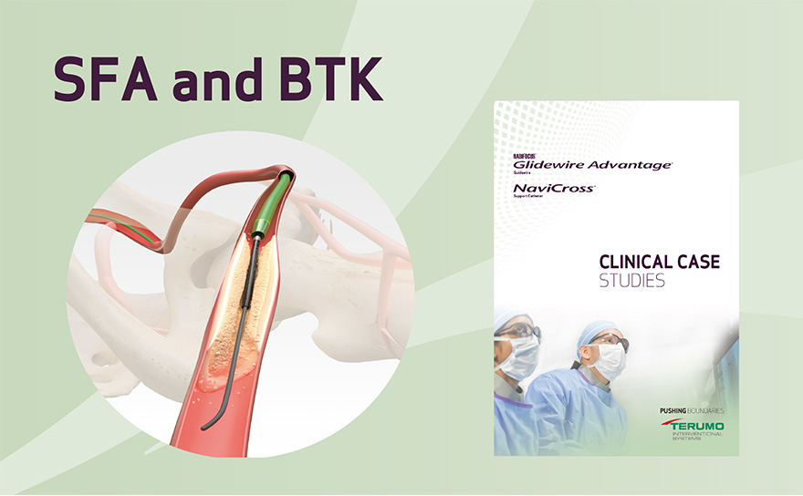 case reports of SFA and BTK CTO
