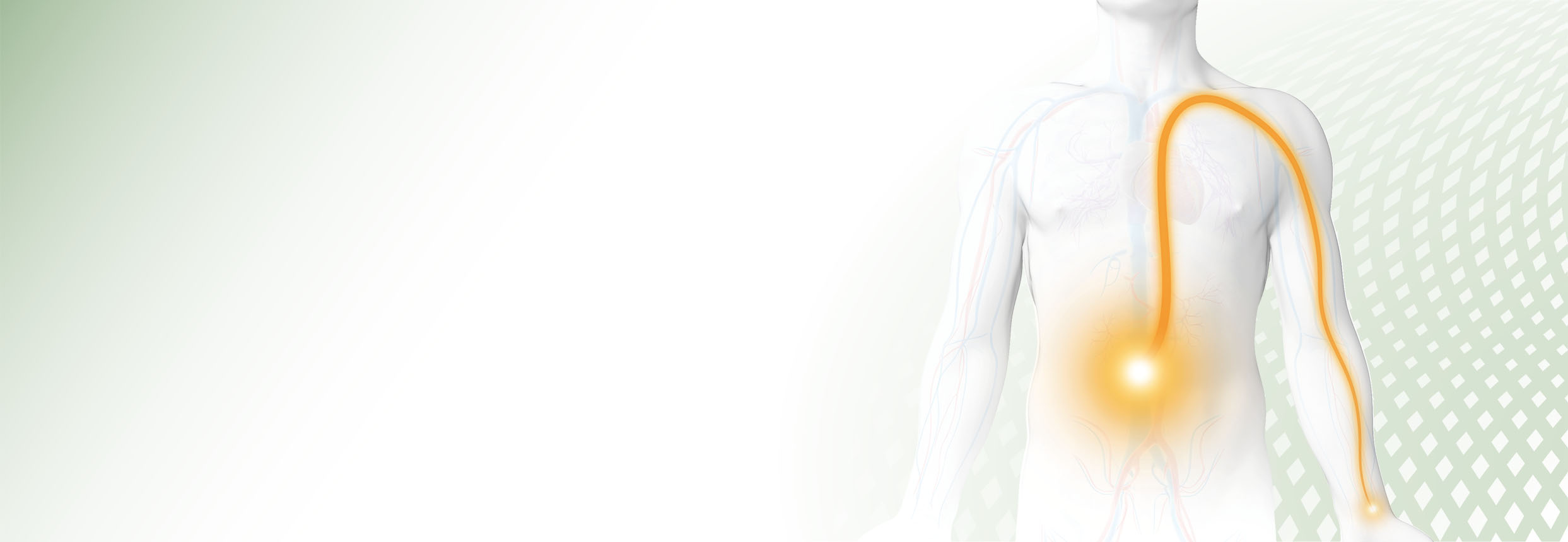 R2V™ - Radial to Visceral (image)