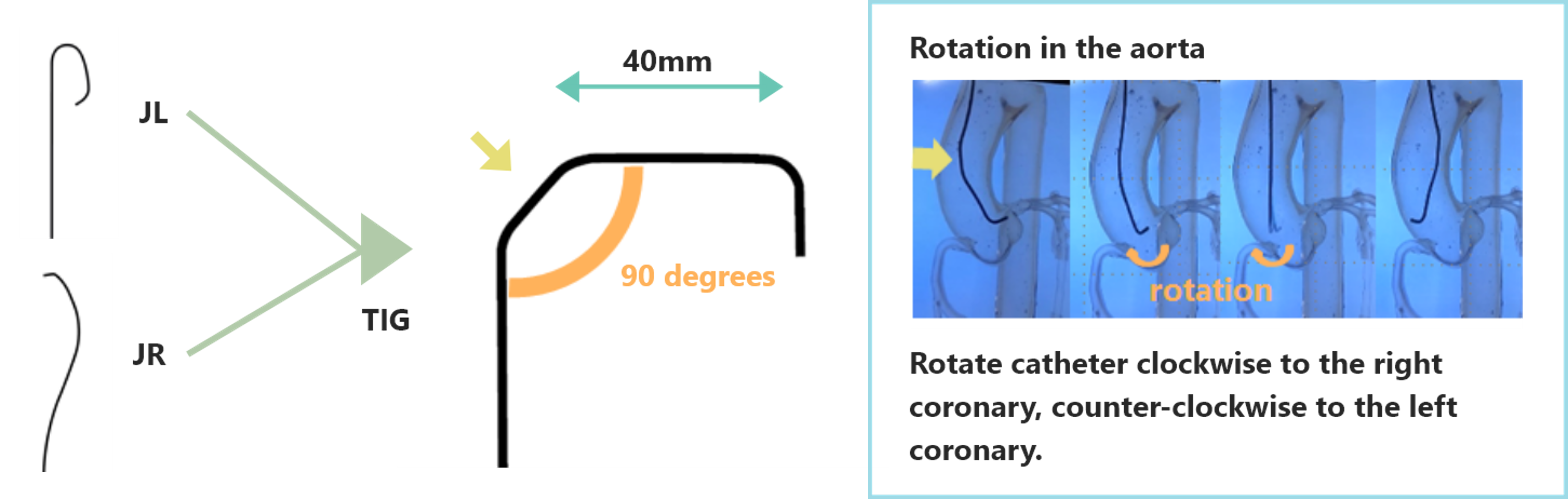 Shape of Optitorque (image)