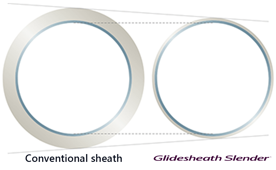 featured_radial_try_tri_sheath_insertion_solution_diameter_880x544