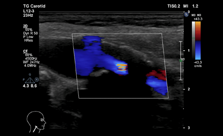 Ultrasound image (Figure2-b)
