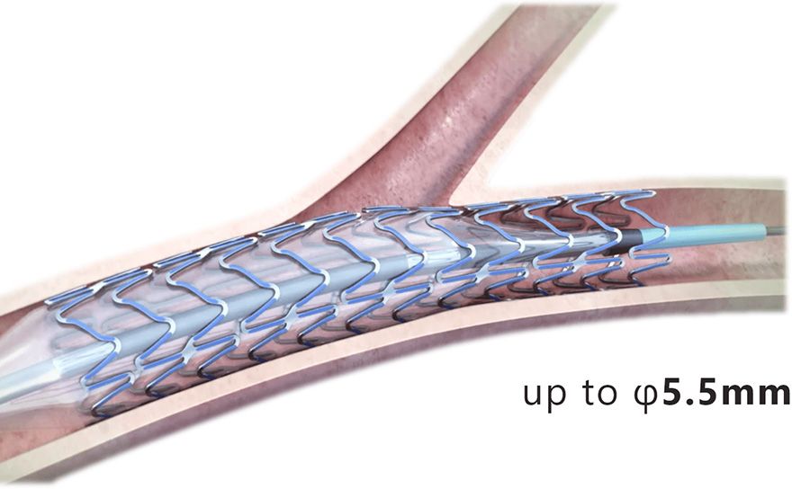 Wider over-expansion range about Ultimaster (image)