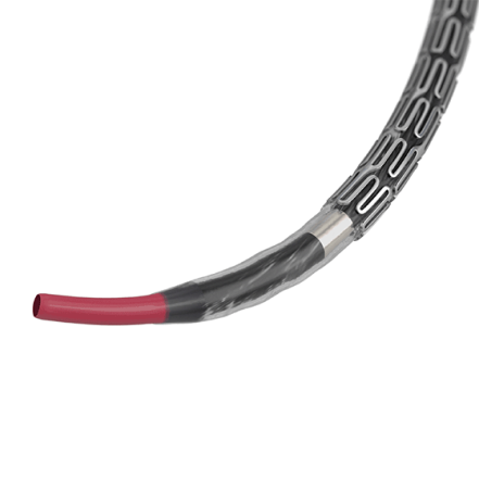 Stent (image)