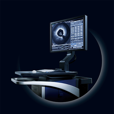 OFDI (image)