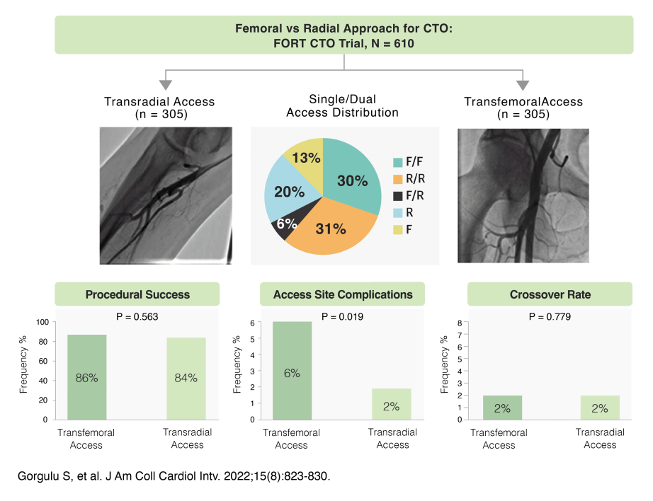 featured_transradial_intervenion_complex_pci_fort-cto-trial.png